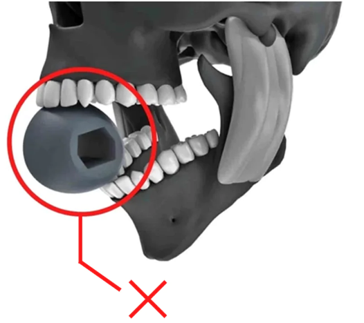 Why Using A Jaw Exerciser On the Front Teeth Is Bad For You