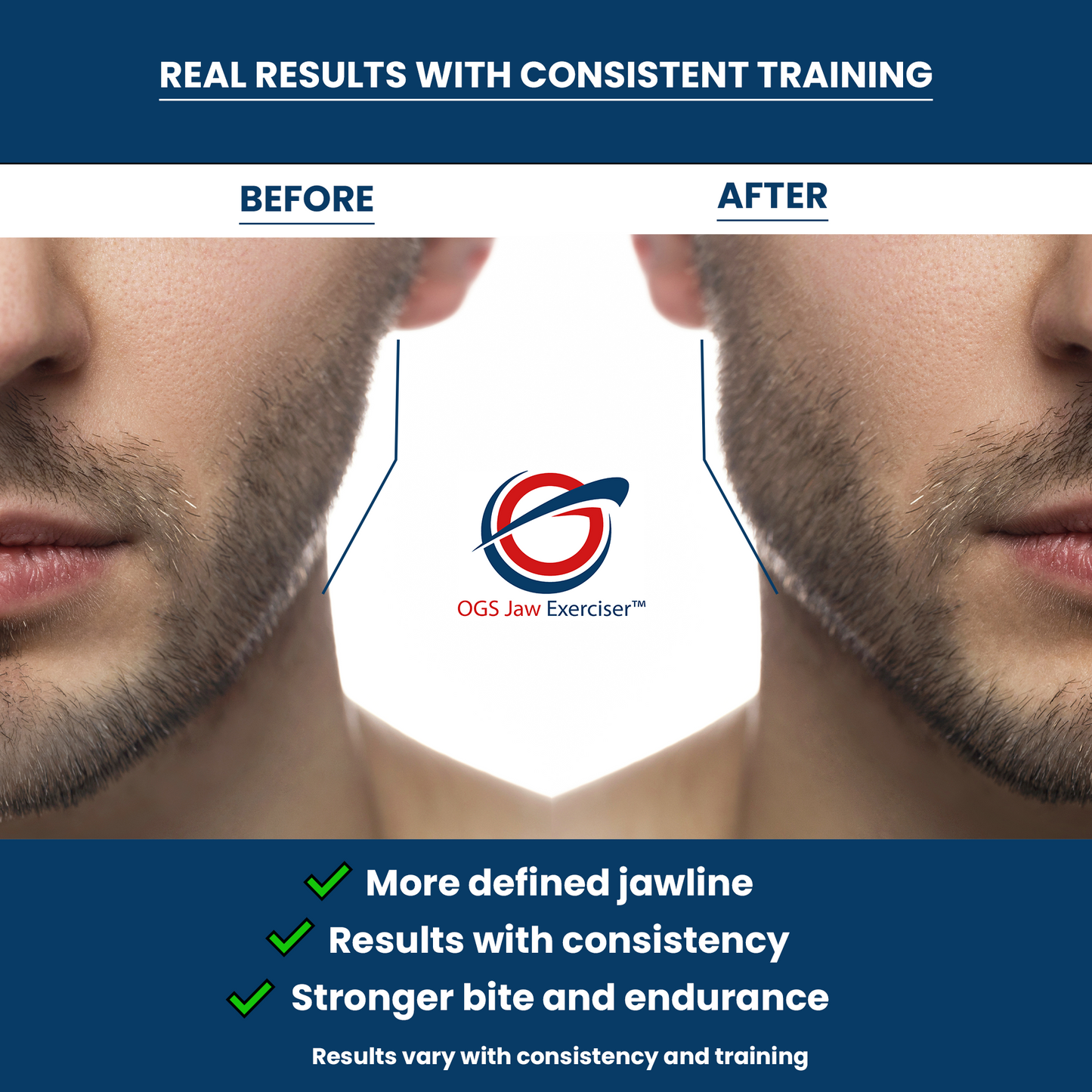 OGS Jaw Exerciser 2.0